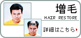 増毛の悩み、詳細はこちら。髪110番ドクターK